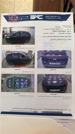 هيونداي كونا